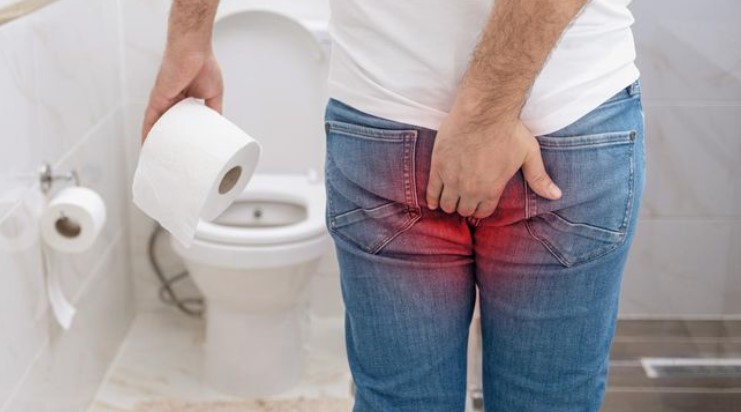 Tips Making Effective Herbal Hemorrhoid Medicine